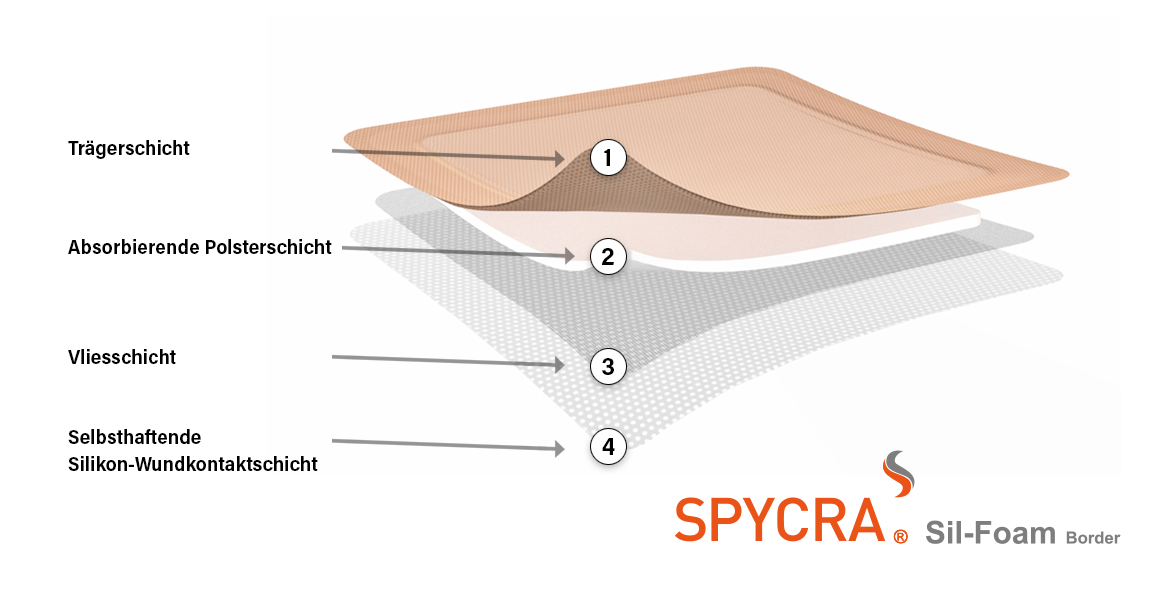 SPYCRA® Sil-Foam Border ist ein steriler, selbstklebender, saugfähigher PU-Schaum mit Haftrand, zur Verwendung bei mittel (mäßig) bis stark exsudierenden und oberflächlich bis tiefen Wunden.